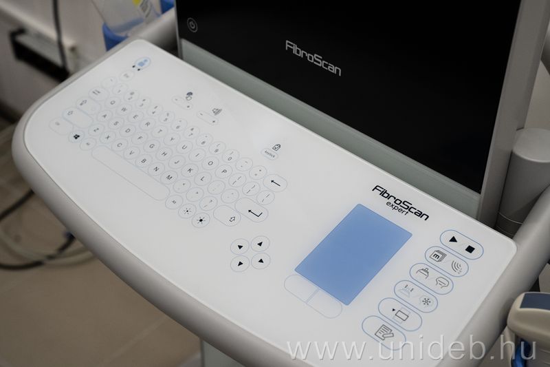 FibroScan, Debreceni Egyetem, Debrecen, Klinikai Központ