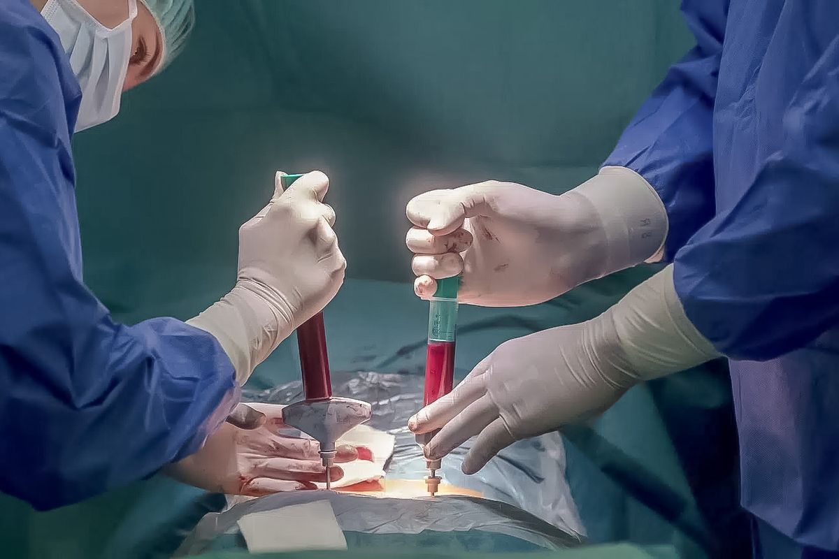 Gerincvelő-transzplantáció a debreceni klinikán