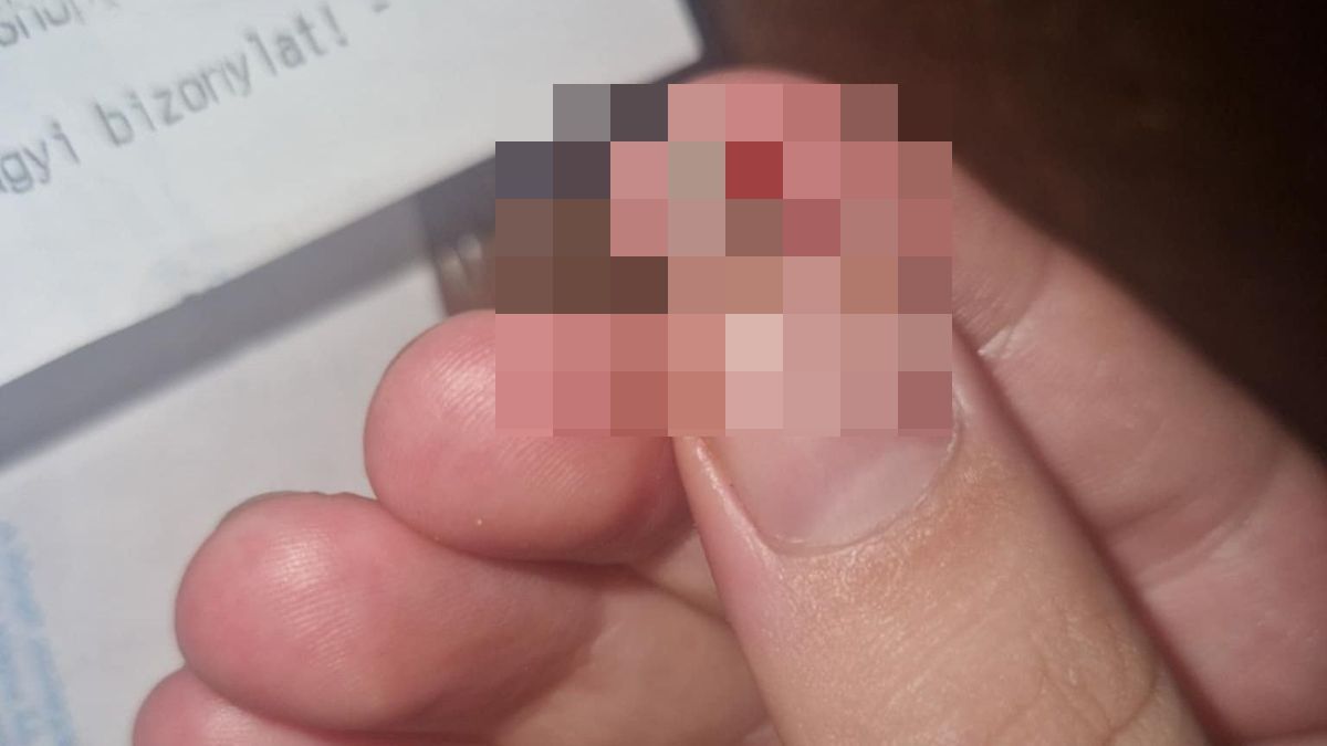 Hátborzongató, mit talált a vacsorára szánt hús közepében egy hajú-bihari vásárló